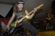 VULVODYNIA